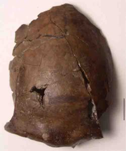 This is the cranium of a person who lived in what's now Papua New Guinea, 6,000 years ago. 