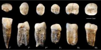 Original fossil teeth"Peking Man.".