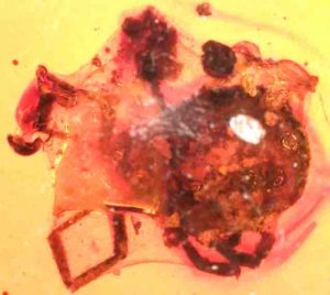 This silk-wrapped tick subsequently was entombed in amber that may have dripped from a nearby tree.