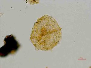 Dinoflagellate cysts