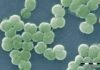 Iron-silica particles helped shield cyanobacteria like these, which played a key role in the oxygenation of Earth's atmosphere according to new research from UAlberta.