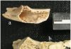 Bone Tumor in 120,000-Year-Old Neandertal Discovered