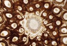Unique chromosomes preserved in Swedish fossil