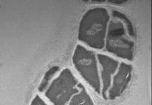 Microbe’s innovation brought doom to Earth