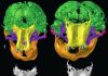 Short lives, violent deaths: Two CT-scanned Siberian mammoth calves yield trove of insights