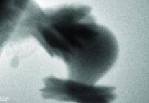 Clues to trapping carbon dioxide in rock