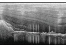 ‘Fountain of youth’ underlies Antarctic mountains