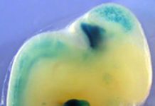 Modern genetics confirm ancient relationship between fins and hands
