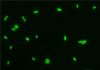 Iron toxicity for cyanobacteria delayed oxygen accumulation in early Earth’s atmosphere