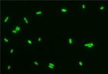 Iron toxicity for cyanobacteria delayed oxygen accumulation in early Earth’s atmosphere