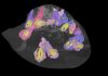 X-rays reveal fossil secrets