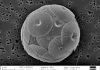 Rapid plankton growth in ocean seen as sign of carbon dioxide loading