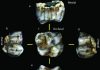 South Africa’s Sterkfontein Caves produce two new hominin fossils