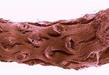 Oldest pine fossils reveal fiery past