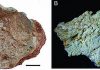 New type of dinosaur eggs found from Early Cretaceous of Gansu Province, China
