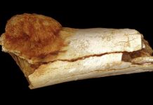 Cancer on a Paleo-diet? Ask someone who lived 1.7 million years ago