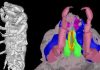 The oldest known parasitic isopod