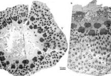 World’s oldest and most complex trees This is an illustrative transverse plane through the small trunk