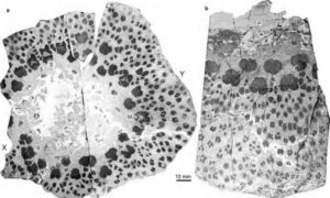 This is an illustrative transverse plane through the small trunk