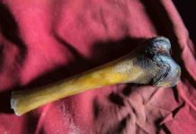 Abominable Snowman? Nope. Study ties DNA samples from purported Yetis to Asian bears A femur bone from the decayed body of a purported Yeti found in a cave in Tibet