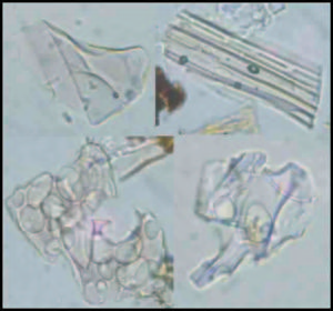 Tephras -- rock fragments and particles ejected by a volcanic eruption.