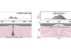 Geophysicists uncover new evidence for an alternative style of plate tectonics Time slices of the computational geodynamic model showing dripping continental root and eventual surface uplift over a 4.5 million year period across Turkey's Central Anatolian Plateau