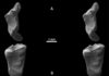 Man’s earliest ancestors discovered in southern England These are fossil teeth under electron microscope.
