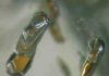 Oxidized iron deep within Earth’s interior Diamonds with garnet inclusions can form at depths down to 550 kilometres below the surface. Credit
