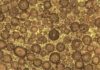 The Pentagon built with mineralized microbes predating dinosaurs cross section of the ooids inside Rogenstein oolite
