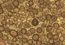 The Pentagon built with mineralized microbes predating dinosaurs cross section of the ooids inside Rogenstein oolite