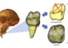 The secret life of teeth: Evo-devo models of tooth development CT-rendered chimpanzee cranium (left) with enlarged image of a virtually extracted molar (middle).