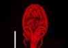 Japanese student discovers new crustacean species in deep sea hydrothermal vent Stygiopontius senokuchiae