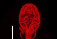 Japanese student discovers new crustacean species in deep sea hydrothermal vent Stygiopontius senokuchiae