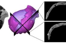 Cranium of a four-million-year-old hominin shows similarities to that of modern humans Original picture (left) and virtual rendering of the Jacovec cranium (middle) with two sections revealing the inner structure (right).