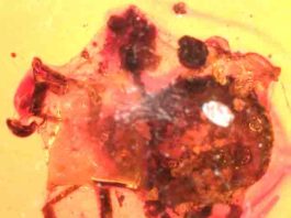 This silk-wrapped tick subsequently was entombed in amber that may have dripped from a nearby tree.