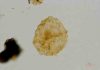 Red tide fossils point to Jurassic sea flood Dinoflagellate cysts