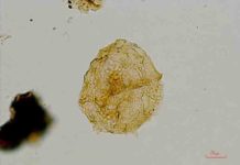 Dinoflagellate cysts