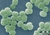 Iron-silica particles unlock part of the mystery of Earth’s oxygenation Iron-silica particles helped shield cyanobacteria like these, which played a key role in the oxygenation of Earth's atmosphere according to new research from UAlberta.