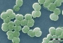 Iron-silica particles unlock part of the mystery of Earth’s oxygenation Iron-silica particles helped shield cyanobacteria like these, which played a key role in the oxygenation of Earth's atmosphere according to new research from UAlberta.