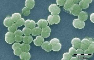 Iron-silica particles helped shield cyanobacteria like these, which played a key role in the oxygenation of Earth's atmosphere according to new research from UAlberta.