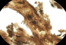 A toast to the proteins in dinosaur bones Dinosaur blood vessel with adjacent bone matrix that still contains bone cells.