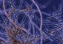 Study Looks to Iron from Microbes for Climate Help Iron-oxidizing bacteria live in environments as extreme as the deep ocean and as common as roadside ditches. A recent paper in Frontiers proposes distributing the iron that these bacteria naturally produce to 'fertilize' phytoplankton and help remove excess carbon dioxide from the atmosphere. Credit: Bigelow Laboratory for Ocean Sciences