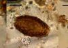Ancient feces reveal how ‘marsh diet’ left Bronze Age Fen folk infected with parasites Microscopic eggs of fish tapeworm (left), giant kidney worm (centre), and Echinostoma worm (right) from the Must Farm excavation. Black scale bar represents 20 micrometres. Credit: Marissa Ledger