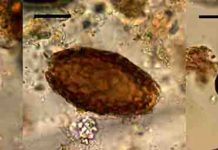Ancient feces reveal how ‘marsh diet’ left Bronze Age Fen folk infected with parasites Microscopic eggs of fish tapeworm (left), giant kidney worm (centre), and Echinostoma worm (right) from the Must Farm excavation. Black scale bar represents 20 micrometres. Credit: Marissa Ledger
