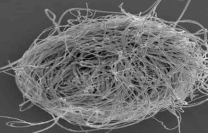 A bundle of giant sperm of the present-day ostracod crustacean Cyclocypris serena. Photo credit: R. Matzke-Karasz.