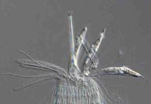 A New Species of Rare Phylum Loricifera Discovered in the Deep-sea Surrounding Japan New loriciferan from Japan: Wataloricus japonicus Credit: Shinta Fujimoto