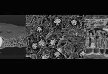 New field of research: Crystal traces in fossil leaves Calcium oxalate crystals - In living plants, calcium oxalate crystals can take on bizarre shapes (from left: hornbeam, button mangrove, Australian nettle) Credit: © Mahdieh Malekhosseini / University of Bonn