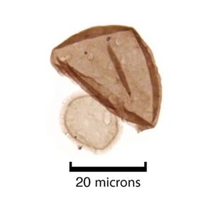 Limbunyasphaera operculata is a new species that shows a small door opening into the cell.Photo Credit: Riedman et al.