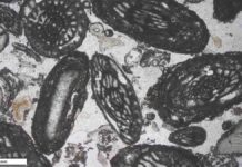 What microscopic fossilized shells tell us about ancient climate change Images of forams created by a scanning electronic microscope. Credit: Dustin Harper