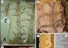 A 296-million-year-old fossil unearthed in Brazil sheds light on ancient plant mystery Different views of the material studied. Credit: Review of Palaeobotany and Palynology (2025). DOI: 10.1016/j.revpalbo.2025.105401